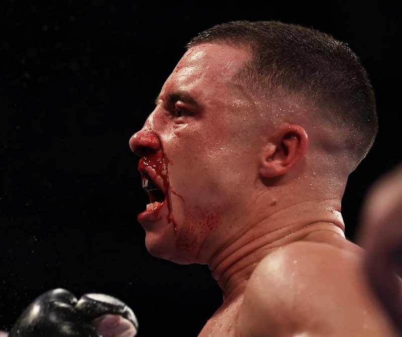 Nick Ball may have suffered a broken nose in his fight with Ronny Rios in the fourth round. Photo: Leigh Dawney, Queensberry Promotions