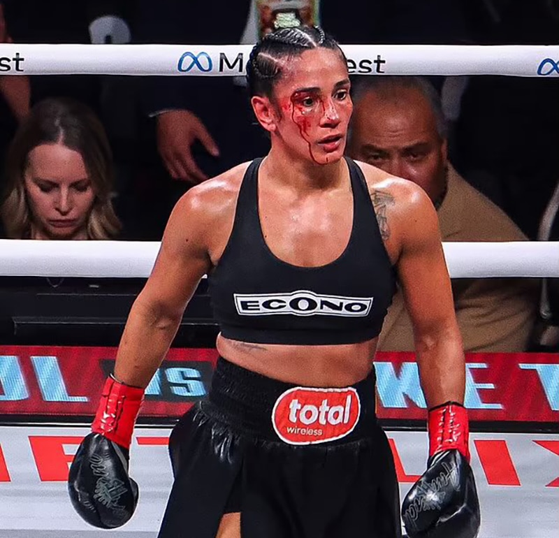 Amanda Serrano wasn't going to let a cut stop her quest to beat Katie Taylor in their rematch. Photo: Ed Mulholland Taylor Serrano II