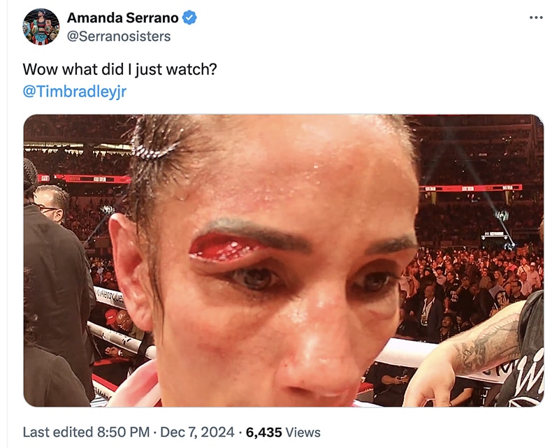 Amanda Serrano, who fought on after a serious cut against Katie Taylor in their rematch, had a strong opinion about Robeisy Ramirez ending his fight against Rafael Espinoza. Photo: SerranoSisters/X Navarrete