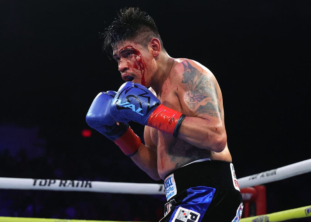 From the moment the cut happened, blood began pouring down Emmanuel Navarrete's face. Photo: Mikey Williams, Top Rank Boxing