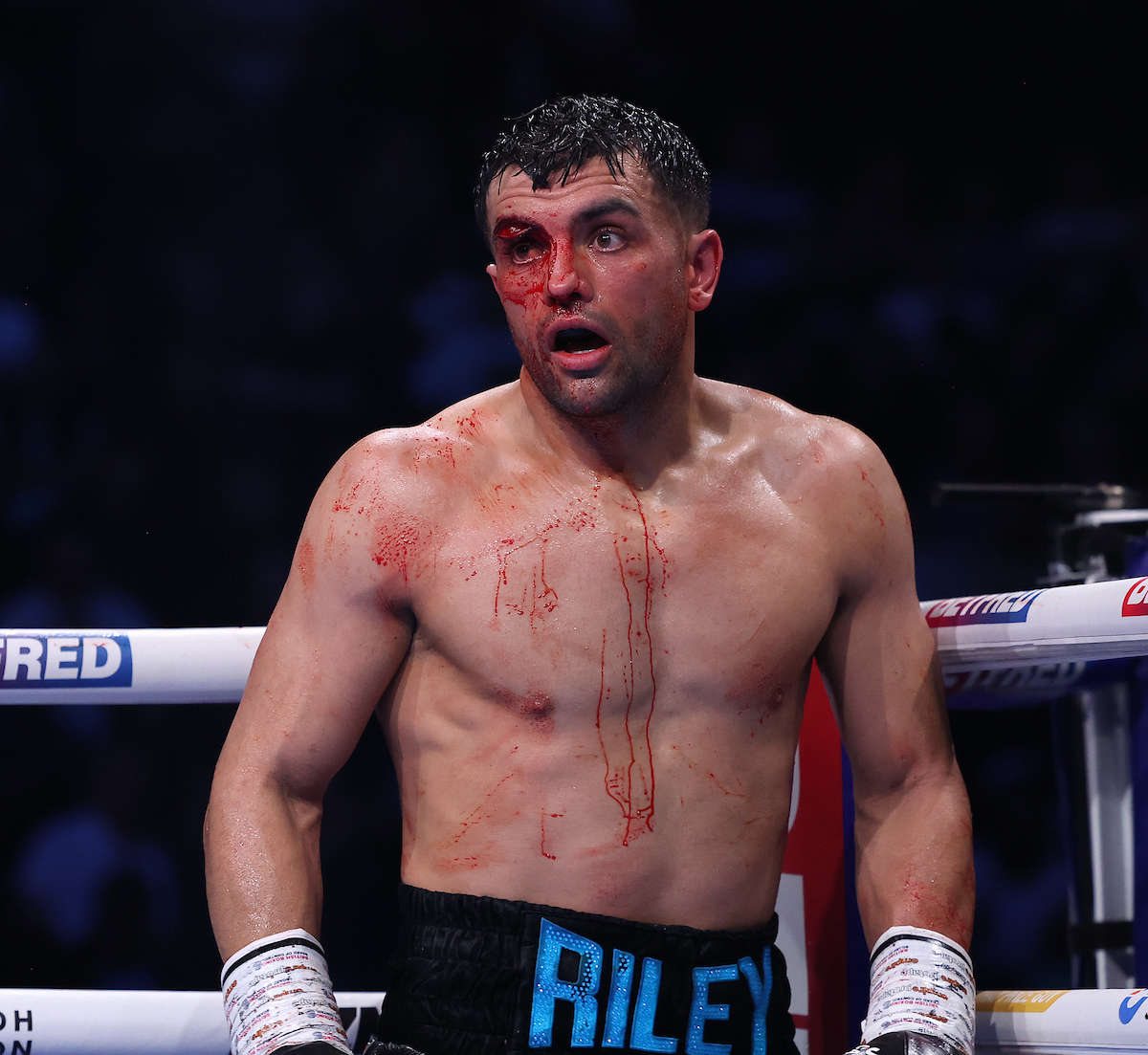 How bad was the cut to Jack Catterall? Pretty damn bad. Photo: Mark Robinson, Matchroom Boxing