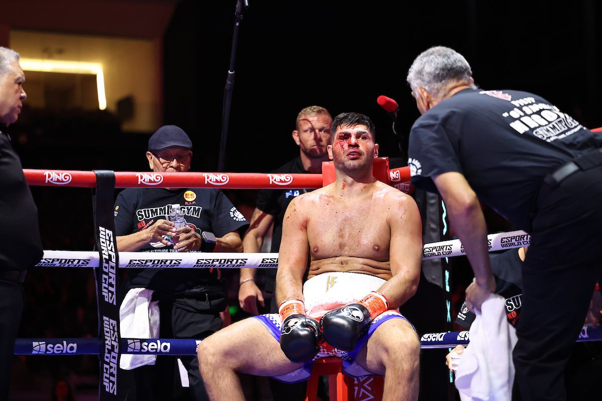 A serious cut threatened the outcome for Filip Hrgovic after the second round. Photo: Leigh Dawney/Queensberry