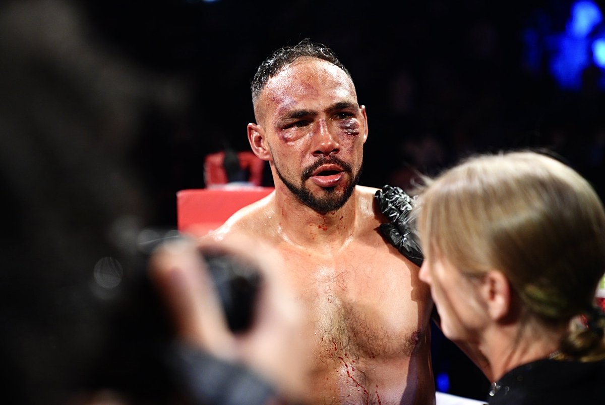 Keith Thurman's battered face reveals the truth about his losing effort against Sebastian Fundora. Photo: Premier Boxing Champions