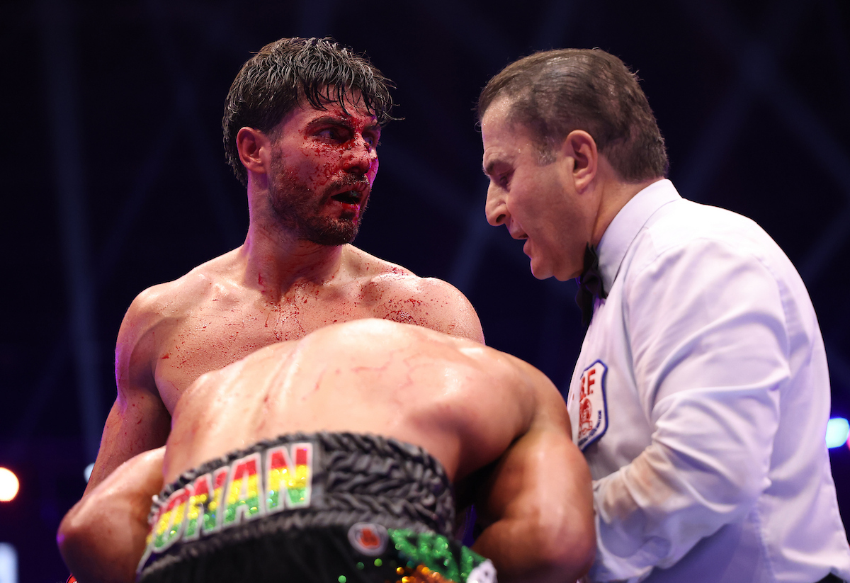 Josh Kelly suffered a broken nose from headbutts in his title defense of the IBF World Super Welterweight belt against Caoimhin Agyarko. Photo: Mark Robinson, Matchroom Boxing Anthony Joshua
