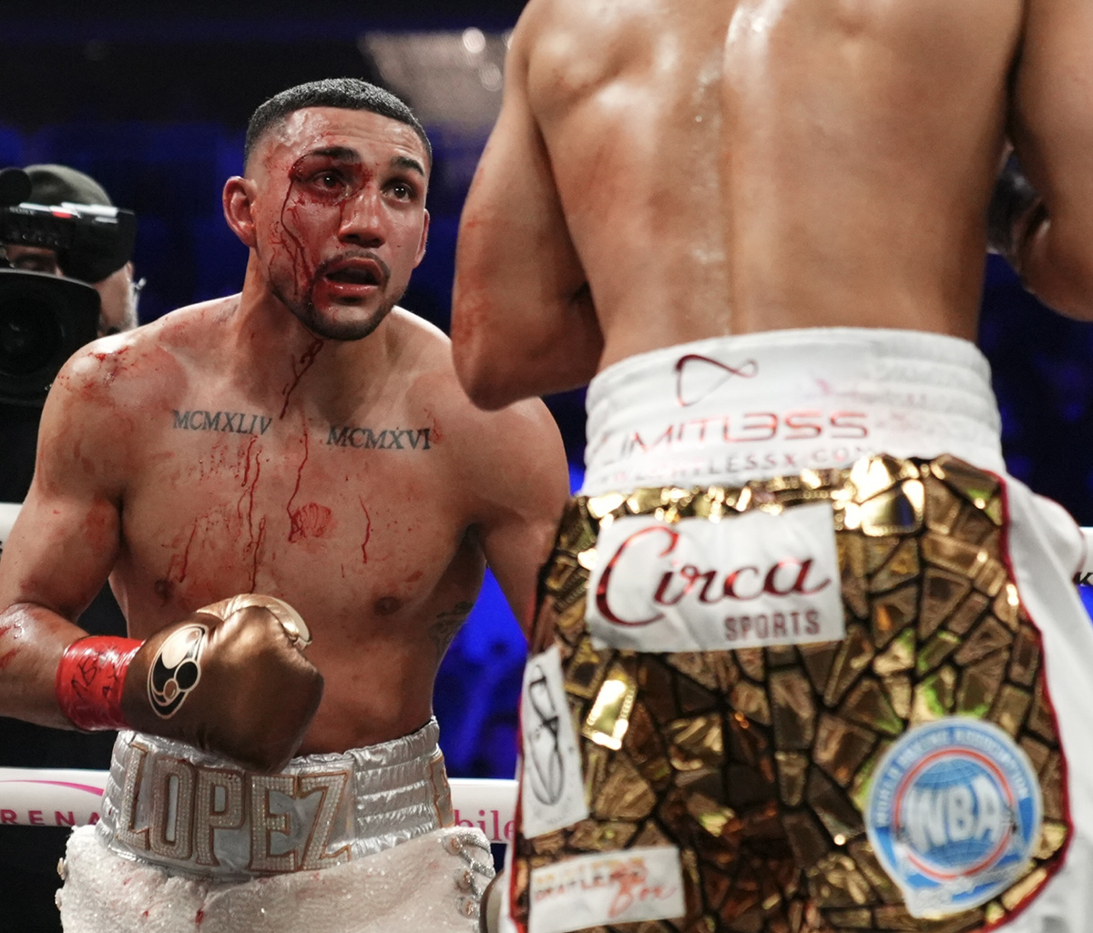 Rolly Romero opened up a significant cut over Teofimo Lopez Jr.'s left eye. It bled heavily when first opened, but the corner got it under control and it didn't affect the fight's outcome. Photo: Premier Boxing Champions