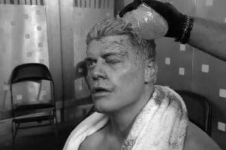 Cody Rhodes swollen eye